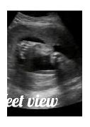 Image result for How Big Is a 28 Week Baby