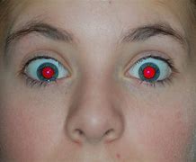 Image result for Why Red Eye