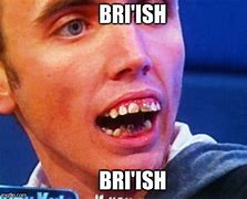 Image result for British Teeth Meme