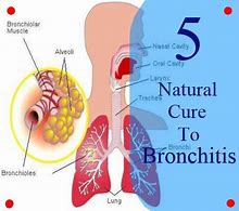 Image result for bronchit