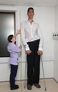 Image result for 210 Cm Guy