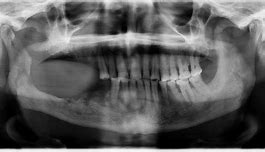 Image result for Ur 501 Jawbone