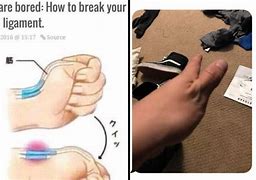 Image result for Dislocating Thumb Meme