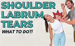 Image result for Torn Labrum Shoulder Exercises