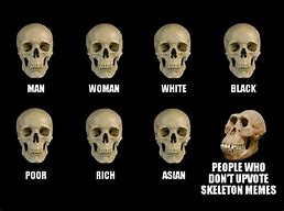 Image result for Skeleton Jaw Meme
