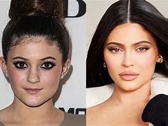 Image result for Kardashian Beauty Cosmetic Surgery