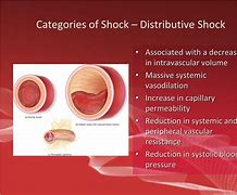 Image result for Distributive Shock EMT