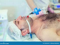 Image result for intubaci�n