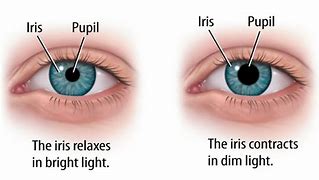 Image result for Bright Light in Eyes