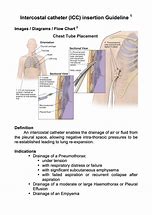 Image result for Chest Tube Drainage