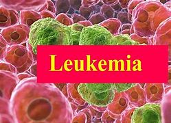 Image result for Leukemia Cancer