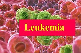 Image result for Leukemia Cancer Pictures