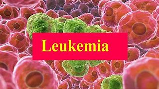 Image result for Leukemia Pathophysiology