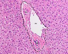 Image result for Hepar Histology