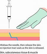 Image result for Sharps Disposal Procedure