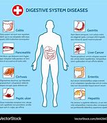 Image result for Digestive Illnesses