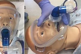 Image result for Anesthesia Mask Breathing