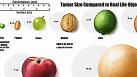 Image result for Cremini Tumor Size