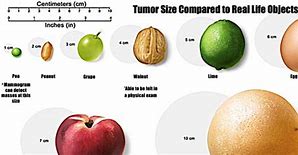 Image result for Cremini Tumor Size
