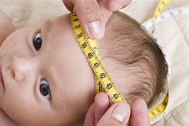 Image result for 1Cm Baby