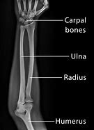 Image result for Humerus Radius/Ulna