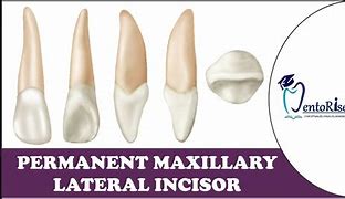 Image result for incisorio