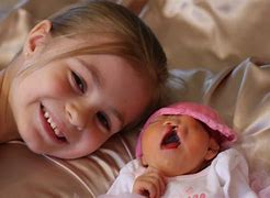 Image result for Oldest Survibing Baby with Anencephaly