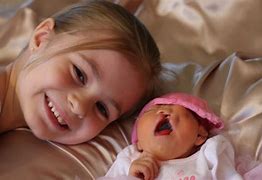 Image result for Anencephaly Baby