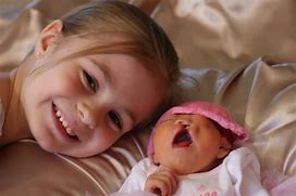 Image result for Anencephalic Baby Dolls