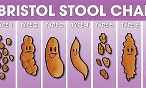 Image result for Grainy Stool in Adults