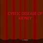 Image result for Localized Cystic Renal Disease