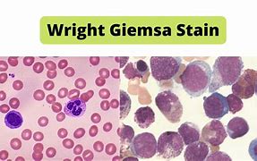 Image result for Staining