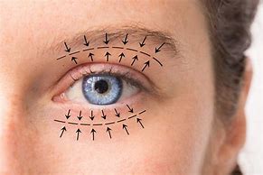 Image result for Blue Eye Surgery