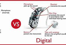 Image result for Analog vs Digital Hearing Aids