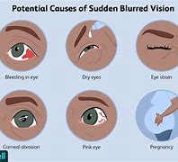 Image result for Blurry Vision in the Dark