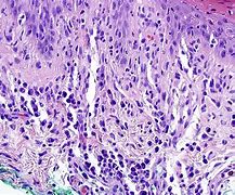 Image result for Syphilis Cell