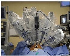 Image result for Robotic Lung Resection