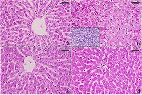 Image result for Normal Liver Pathology