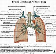 Image result for Hilar Nodule Lung