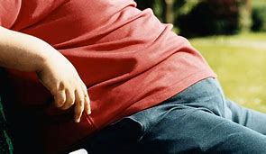 Image result for Obesity