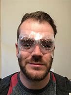 Image result for After Lasik Surgery