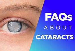 Image result for Cataract Meme