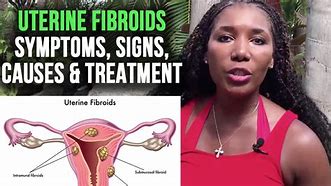 Image result for Fibroid Tumor in Cervix