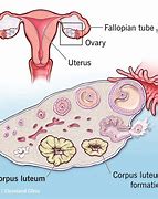 Image result for Cystic Follicle
