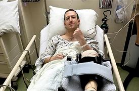 Image result for MMA Injury