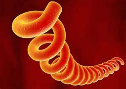 Image result for Syphilis