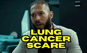 Image result for Andrew Tate Lung Cancer