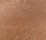 Image result for Vellus Hair Part