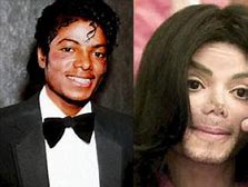 Image result for MJ Before and After Plastic Surgery