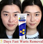Image result for Water Warts Cream